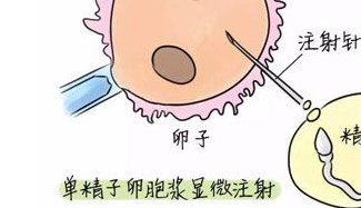 河北正规生殖医院做三代试管婴儿成功率高吗？