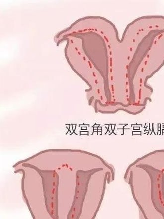 40岁促卵泡激素FSH30多可以正常促排取卵吗？