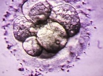 44岁在西安试管移植成功率高吗，高龄试管助孕初次成功概率分析